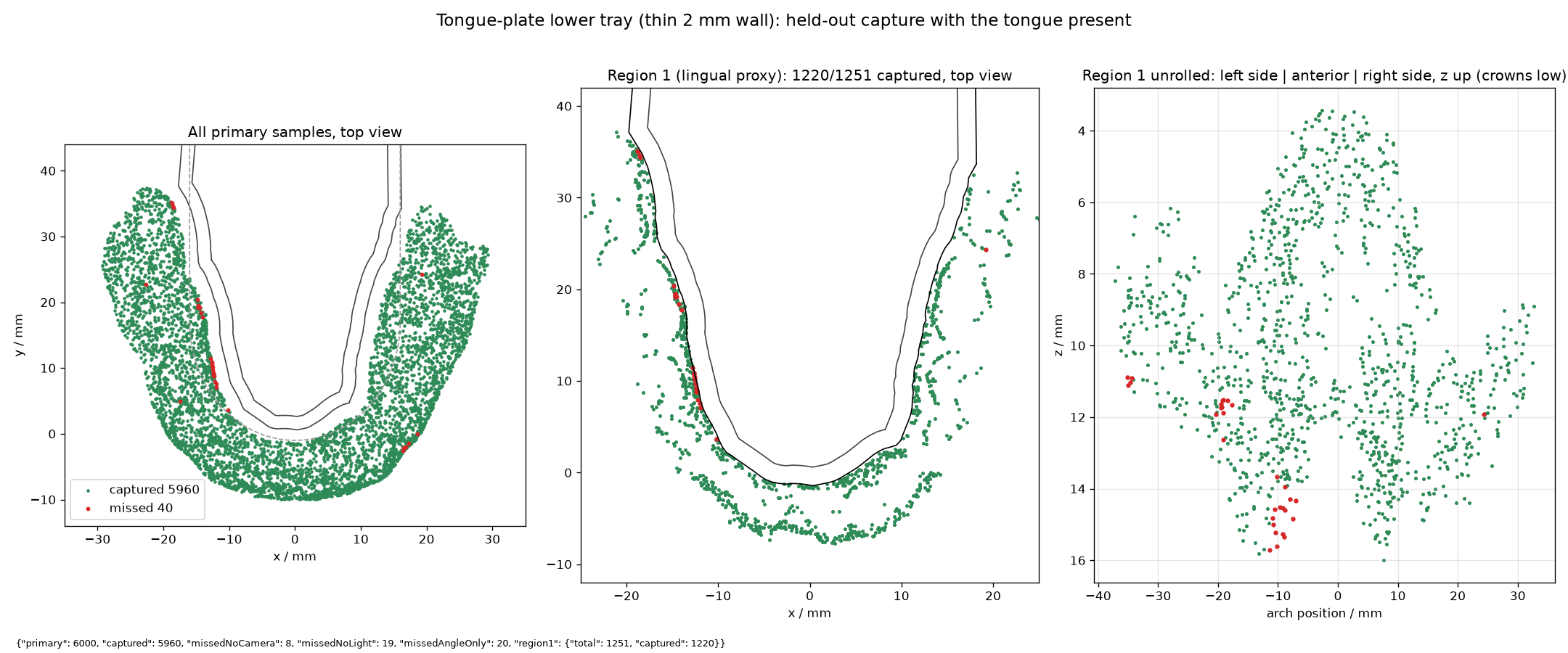 Held-out capture of the tongue-plate design with the tongue present